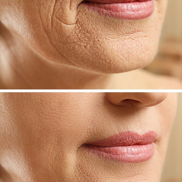 Body and Face Clinique