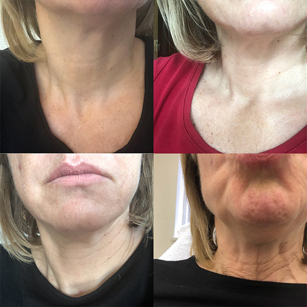 Body and Face Clinique