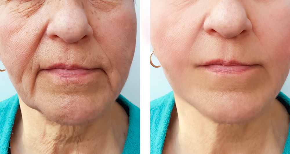 Body and Face Clinique